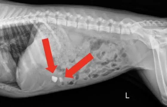 Abdominal x-ray with arrows pointing to a foreign body